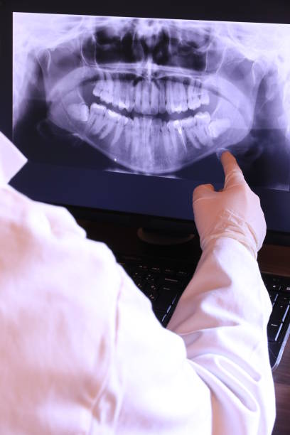 Best Knocked-Out Tooth Emergency  in Scaggsville, MD
