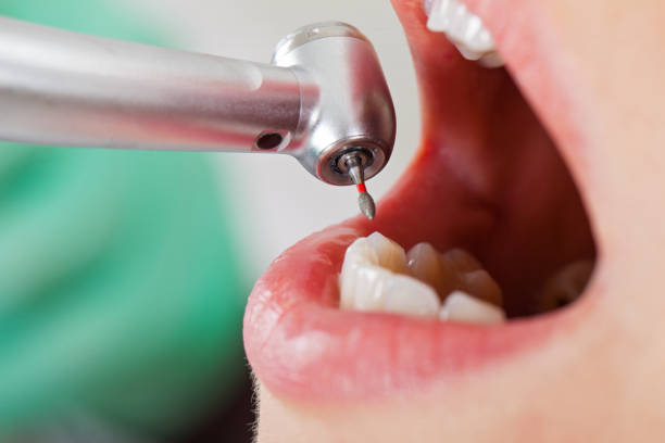 Best Emergency Gum Pain Relief  in Scaggsville, MD